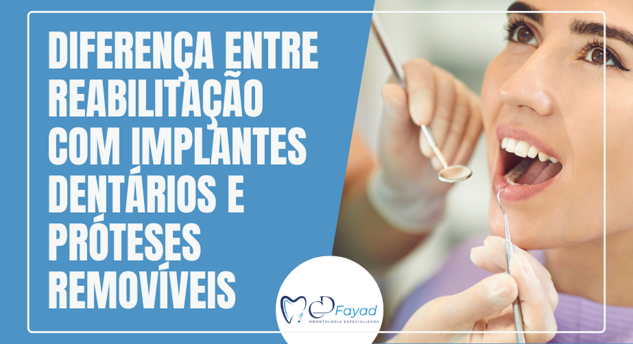 Diferença entre Reabilitação com Implantes Dentários e Próteses Removíveis